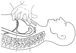 The top panel shows a schematic of a person performing CPR and demarcates the region in the chest where the compression must be performed.