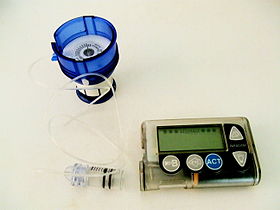 Insulin pump, showing an infusion set loaded into spring-loaded insertion device. A reservoir is attached to the infusion set (shown here removed from the pump).
